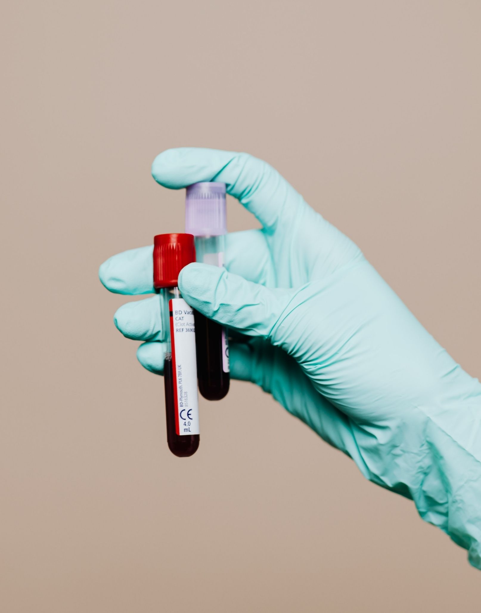 Functional medicine testing